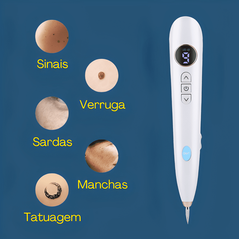 RenovaSkin - Removedor De Marcas De Pele, Cravos, Verrugas ect - Laser Elétrico - Kit Cauterizador