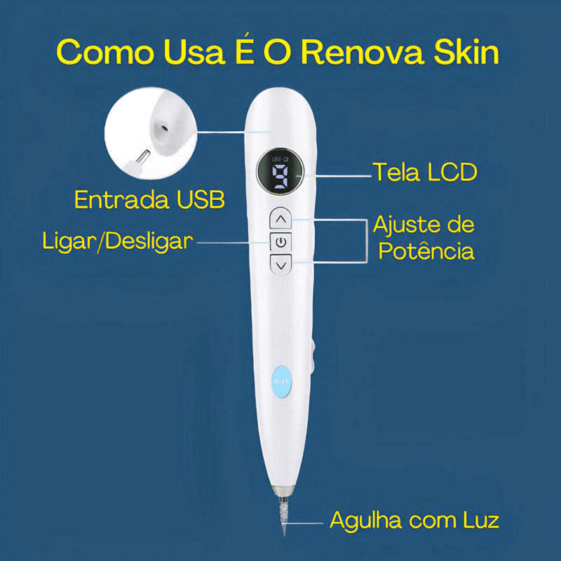 RenovaSkin - Removedor De Marcas De Pele, Cravos, Verrugas ect - Laser Elétrico - Kit Cauterizador